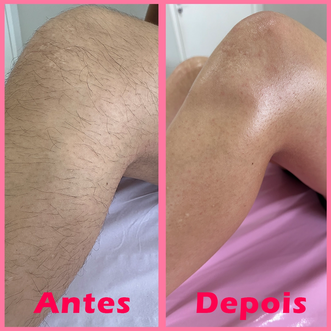 imagem-antes-depois-1