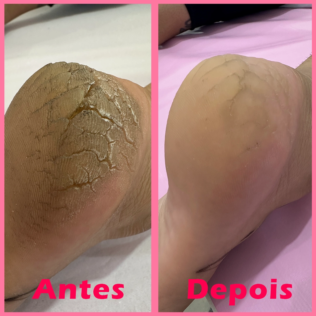 imagem-antes-depois-2